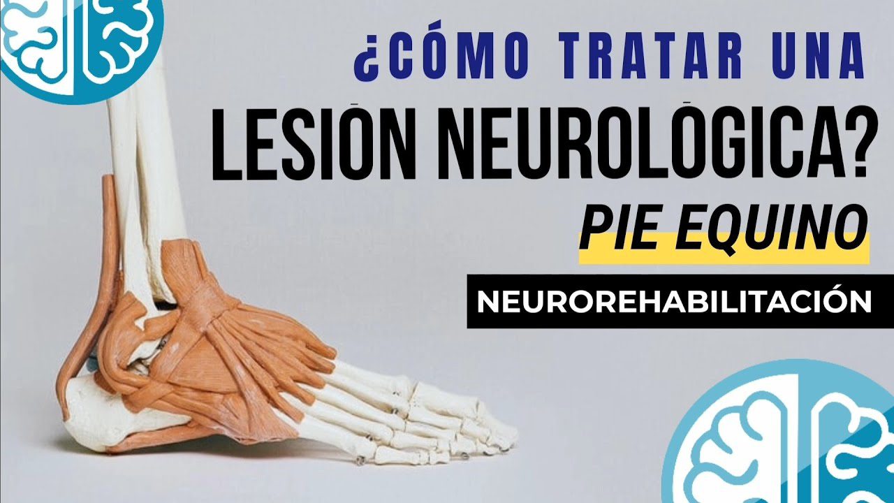 que-hace-exactamente-un-Especialista-en-rehabilitacion-para-personas-con-protesis-neurales - Notadeprensa.eu